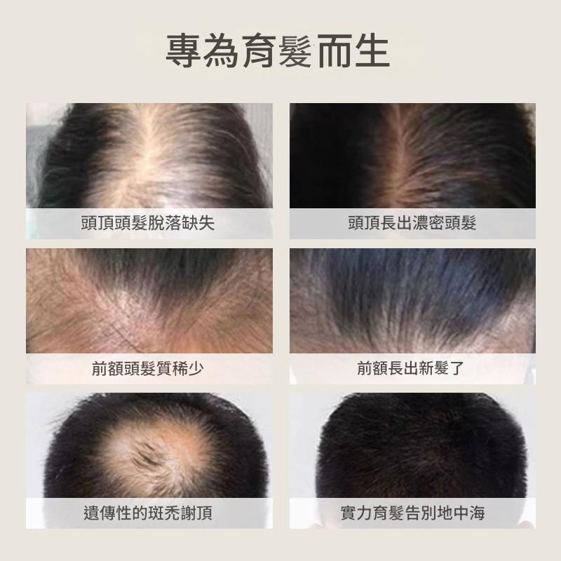 儒意防脫烏發育發液100ml