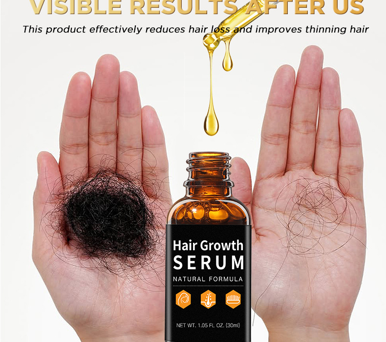 oilyoung【強健髮根營養液】30ml x2