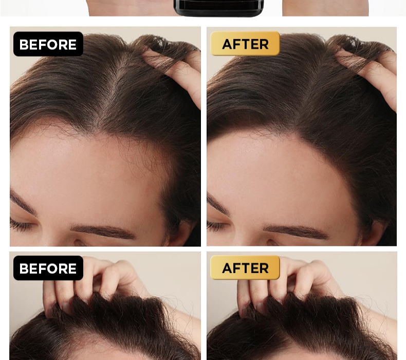 oilyoung【強健髮根營養液】30ml x2