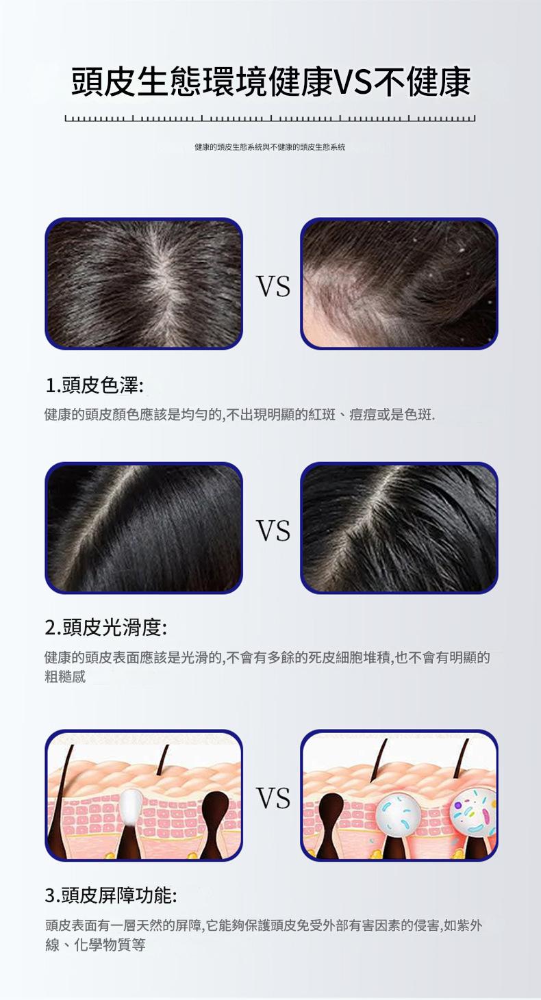 防脫固發頭皮護理精華液8gx4瓶/盒