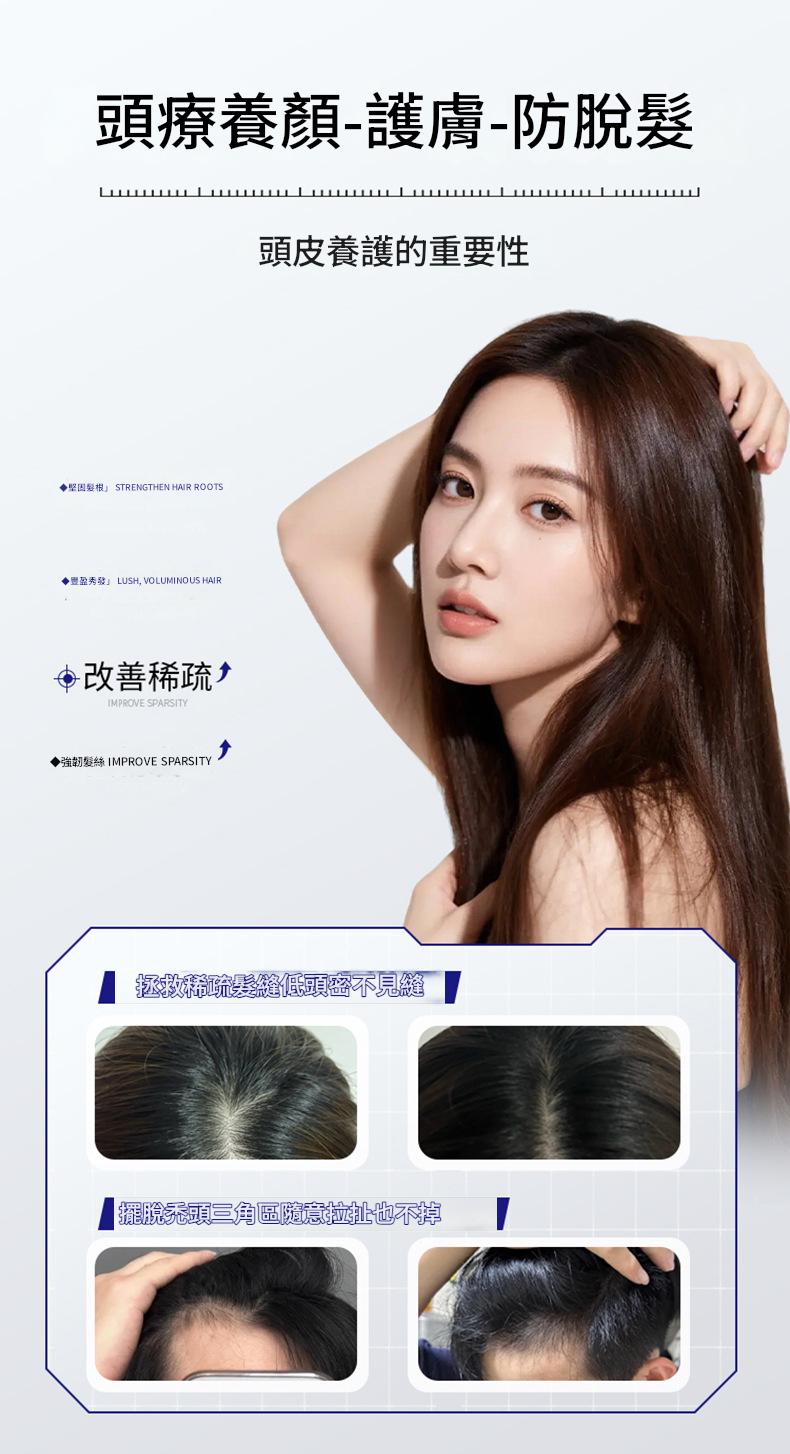 防脫固發頭皮護理精華液8gx4瓶/盒 防脫固發頭皮護理精華液8gx4瓶/盒