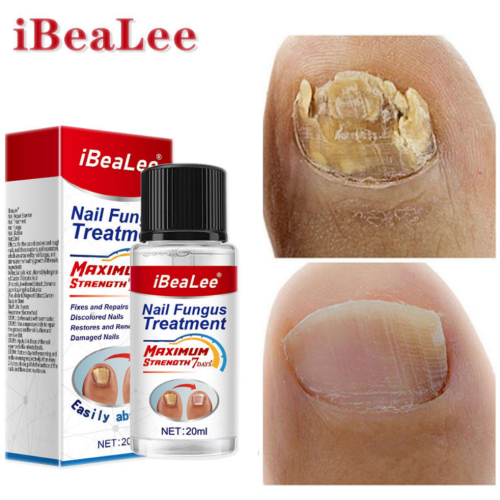 iBeaLee 灰指甲抑菌液 脫甲膏軟甲修護套裝 20ml/瓶