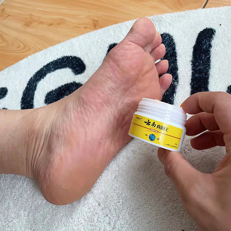 天指山雲南真菌王抑菌乳膏 25克/樽 3樽 - Image 3